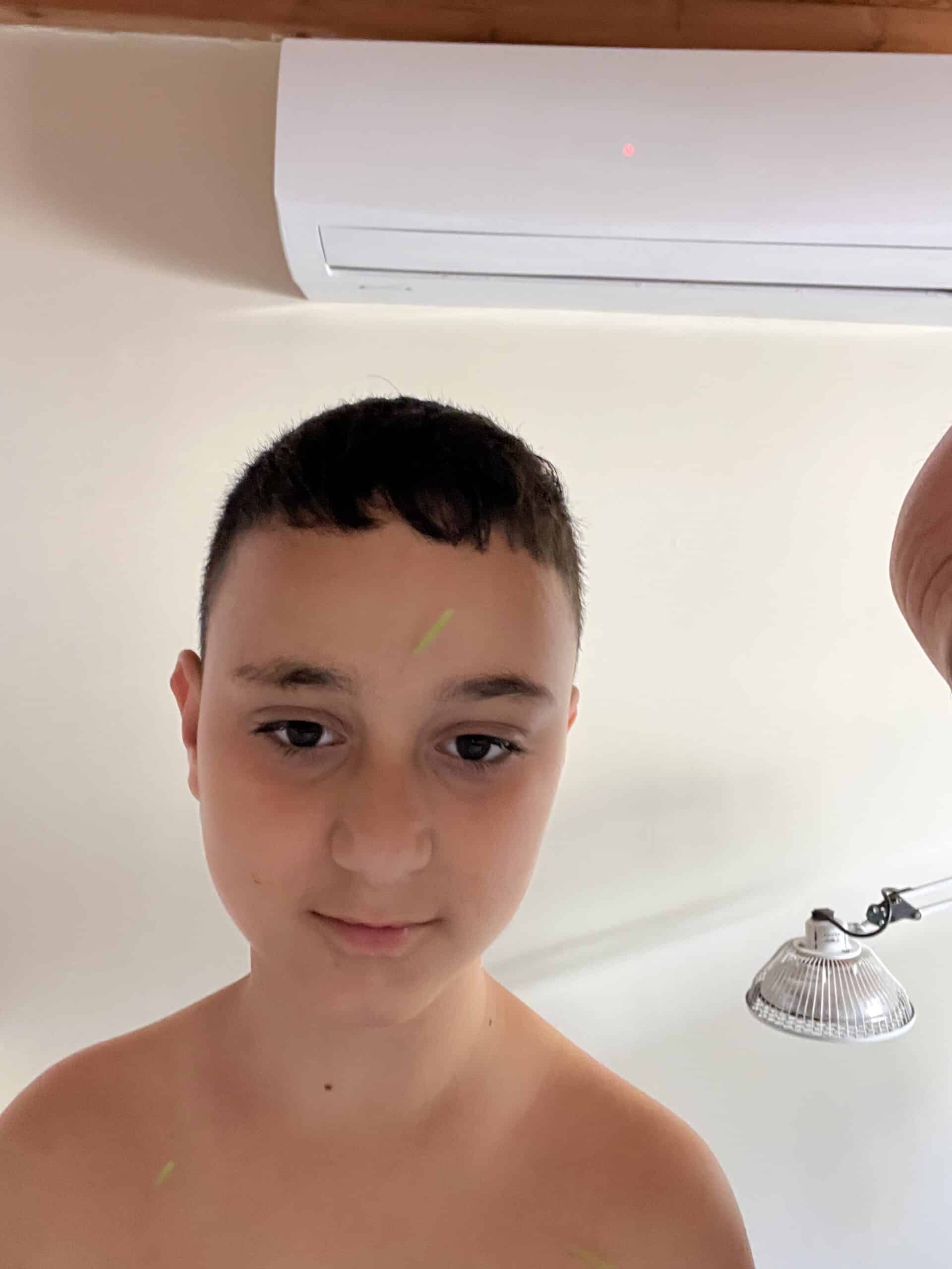 אחרי טיפול ל”טיקים “ אצלנו בטיפטיפול