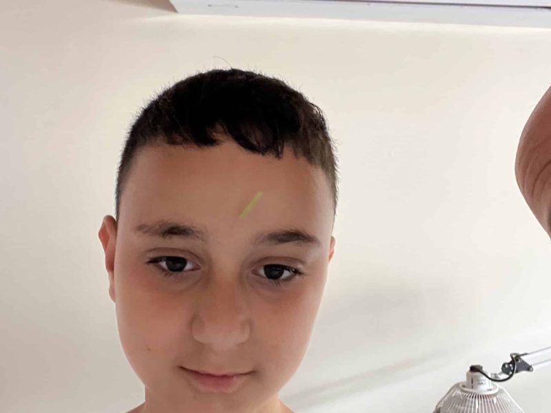אחרי טיפול ל”טיקים “ אצלנו בטיפטיפול
